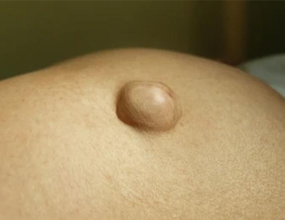 img5